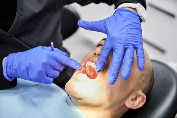 Best Emergency Dentist for Knocked-Out Tooth in Chestnut Ridge, NY