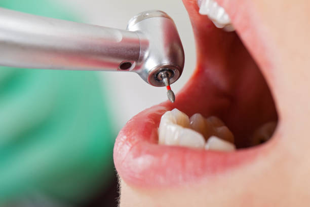 Best Emergency Dental Services for Seniors in Chestnut Ridge, NY